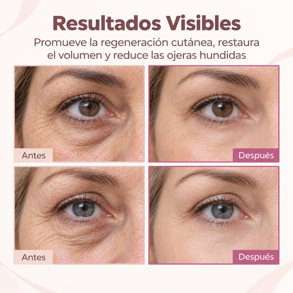 La Ampolla en Barra que Rescata tu Mirada y tu Cuello en 5 Segundos